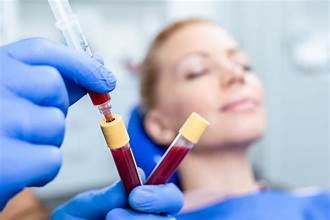 PRP Therapy Treatment Dubai